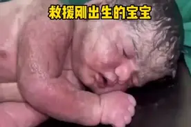 #每一个生命都值得呵护 #刚刚出生的小宝宝 #产房故事 #感人一幕视频封面