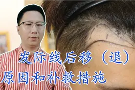 发际线后移原因和补救措施视频封面