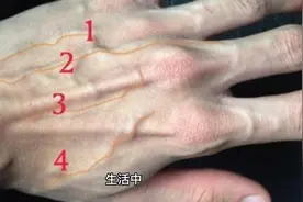 手臂上青筋暴起的原因视频封面