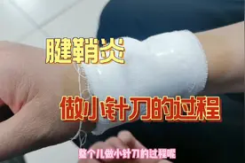 腱鞘炎一直没好，去北京丰盛医院做小针刀，效果如何？附详细流程