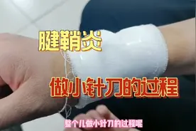 腱鞘炎一直没好，去北京丰盛医院做小针刀，效果如何？附详细流程