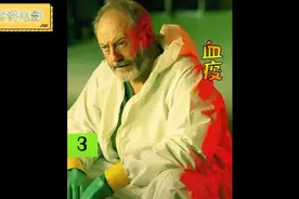 埃博拉病毒给人类带来了特别大的伤害。视频封面
