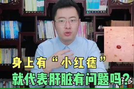 身上有小红痣，就代表肝脏有问题？医生告诉你真正原因！视频封面