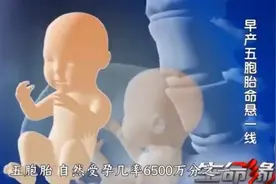 中大奖！孕妇冒险生下5胞胎，最小的孩子仅鸡蛋大小视频封面