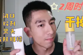 水杨酸这样用，2周时间干掉闭口、粉刺、黑头、皮肤粗糙！视频封面