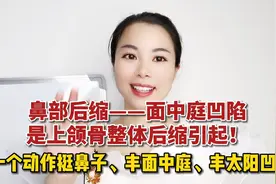鼻部后缩面中庭凹陷，一个动作挺鼻子👃丰太阳凹，坚持7天特管用视频封面