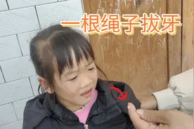 小女儿牙齿还没掉，里面的新牙就长出来了，用一根细绳子帮它拔掉视频封面