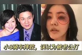 小S骑车摔伤：脸上破相，被众人误会是家暴视频封面
