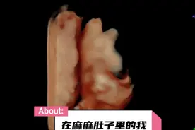 #怀孕23周的四维 看着小小的你 满心欢喜期待宝宝你的到来！视频封面