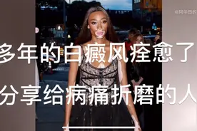 邻居的白癜风痊愈了，真实案例分享给需要的人！视频封面