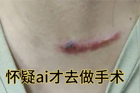 甲亢彩超出怀疑是ai视频封面
