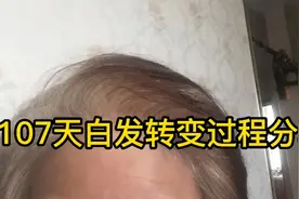 白转黑打卡107天，真实记录白发转黄转灰的转变过程视频封面