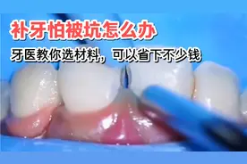 补牙怕被坑怎么办？看看牙医如何教你选材料，让你省下不少钱视频封面