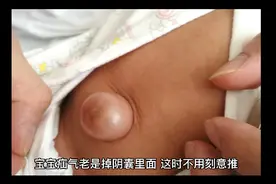 宝宝疝气掉入阴囊不用慌
