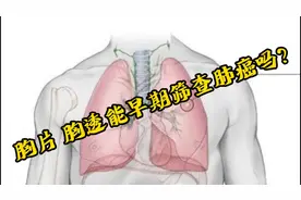 胸片 胸透能早期筛查肺癌吗？视频封面