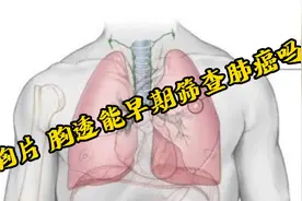 胸片 胸透能早期筛查肺癌吗？视频封面