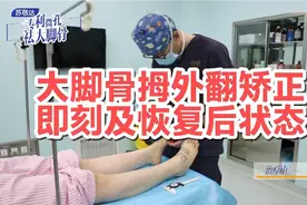 大脚骨拇外翻矫正即刻及1-3个月恢复后状态视频封面
