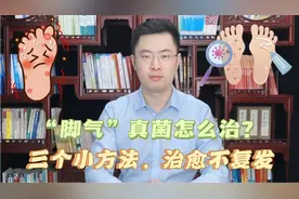 “脚气”真菌怎么治才能根除？三个简单小方法，彻底治愈不复发！视频封面