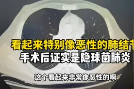手术之前主任说是恶性，手术切出来却是感染，到底是什么细菌？视频封面