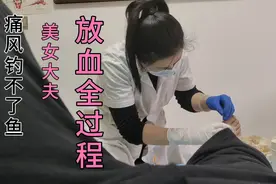 美女大夫，放血全过程，#野钓王#痛风钓不了鱼，去放血治疗太痛了视频封面