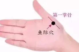 治疗咽喉肿痛、肺炎等肺系疾病的特效穴～鱼际穴视频封面