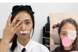 麦粒肿or霰粒肿手术全攻略视频封面