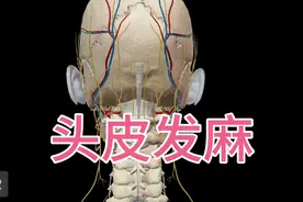 这几天来了好几位患者，都是头皮发麻，原因几乎一样！视频封面