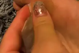 撕脚皮有多爽，一定要看到最后视频封面