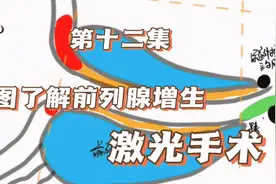 从图了解前列腺增生第十二集-激光手术，怎么做？并发症如何？视频封面