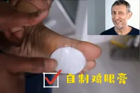 帮你把手上或脚上顽固的茧给消灭掉！快来试试吧