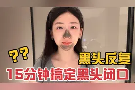 15分钟搞定黑头闭口 泥膜深层清洁拒绝反复