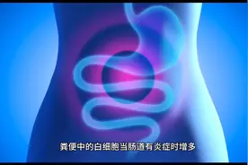 检验结果解读：粪便白细胞视频封面