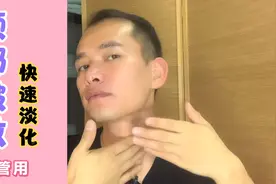 颈部皱纹越来越多人显老，每天三分钟快速淡化，60也不显老。视频封面
