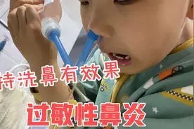 生理盐水坚持洗鼻两周了效果很好，已经没有黄脓鼻涕，洗鼻管好用视频封面