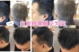 白发转黑眼见为实，事实为证，跟验证转黑效果视频封面