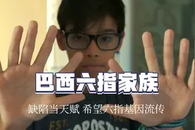 六根手指也能有用漂亮，神奇的巴西六指家族视频封面