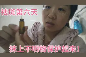 宝妈祛斑第六天，清早起来已经有一两个开始掉痂了！怎么办？视频封面