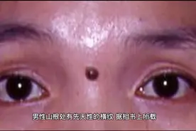 山根有横纹的女性易患性冷感症视频封面