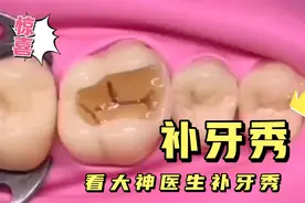 补牙全程视频，看看补牙时医生在你的嘴里做了什么，涨知识了视频封面