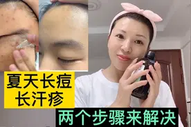 长痘长汗疹不用怕，两个步骤来解决，华姐和女儿亲测有效！