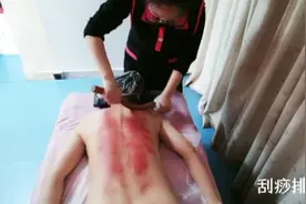 背部刮痧手法全过程。湿寒气重不重，刮痧就能看出来视频封面