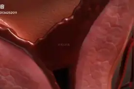 为啥用私护凝胶帮忙排毒消炎杀菌了吗[发呆]视频封面