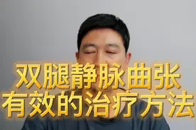 你双腿有小蚯蚓吗？医生教你几个有效的冶疗方法，快来看看吧！视频封面
