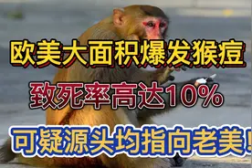 欧美爆发猴痘病毒，致死率高达10％，美实验室猴子出逃有何关系？视频封面