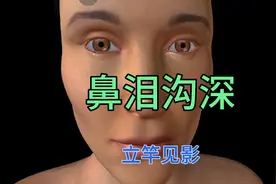 快速矫正鼻泪沟深！