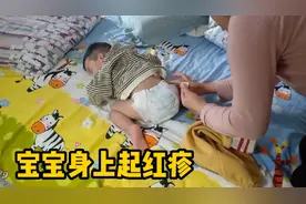 1岁多的宝宝莫名长了很多红疹子，一抓红一大片，关键还特别痒视频封面