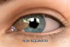 眼角长肉是什么病，眼角翼状胬肉原因和治疗，3D演示。。视频封面