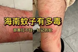 海南蚊子有多毒，一般游客扛不住，又大又痒！视频封面