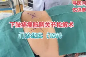 乡医杨涛：下肢疼痛，腿疼，弯腰困难，有可能是骶髂关节引起的视频封面
