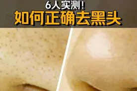 【真人实测】放大150倍的毛孔有多脏？6种去黑头方式红黑榜！视频封面
